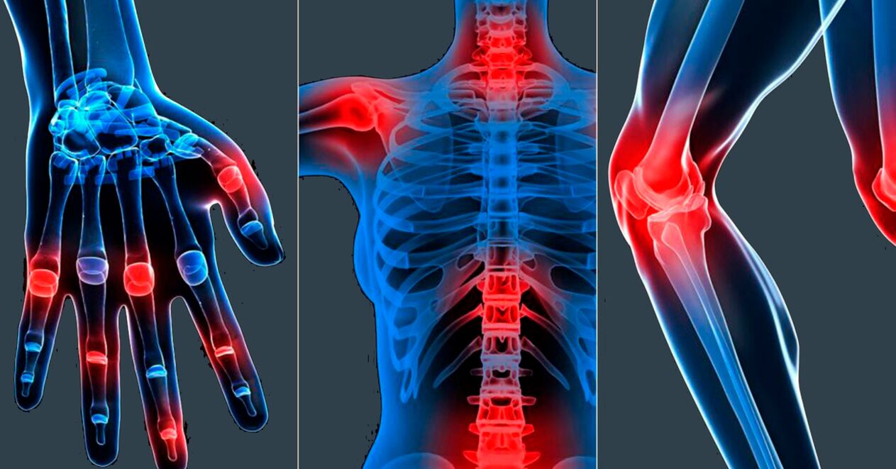 Hinweise zur Verwendung von Boswellia-Extrakt in Kapseln
